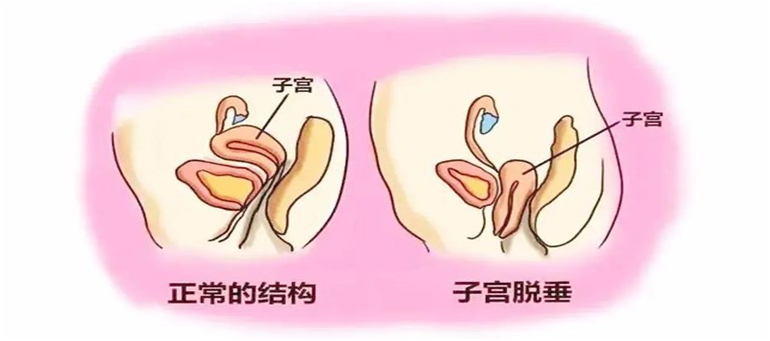 1692061519179324.png image.png