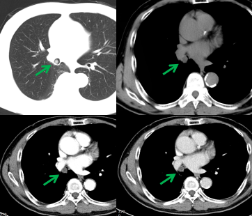 1698652458119032.png 640.png