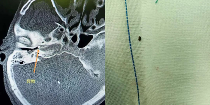 1700882125580902.jpg 640 (2).jpg