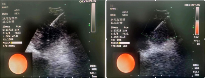 1704241536187770.png 640 (1).png