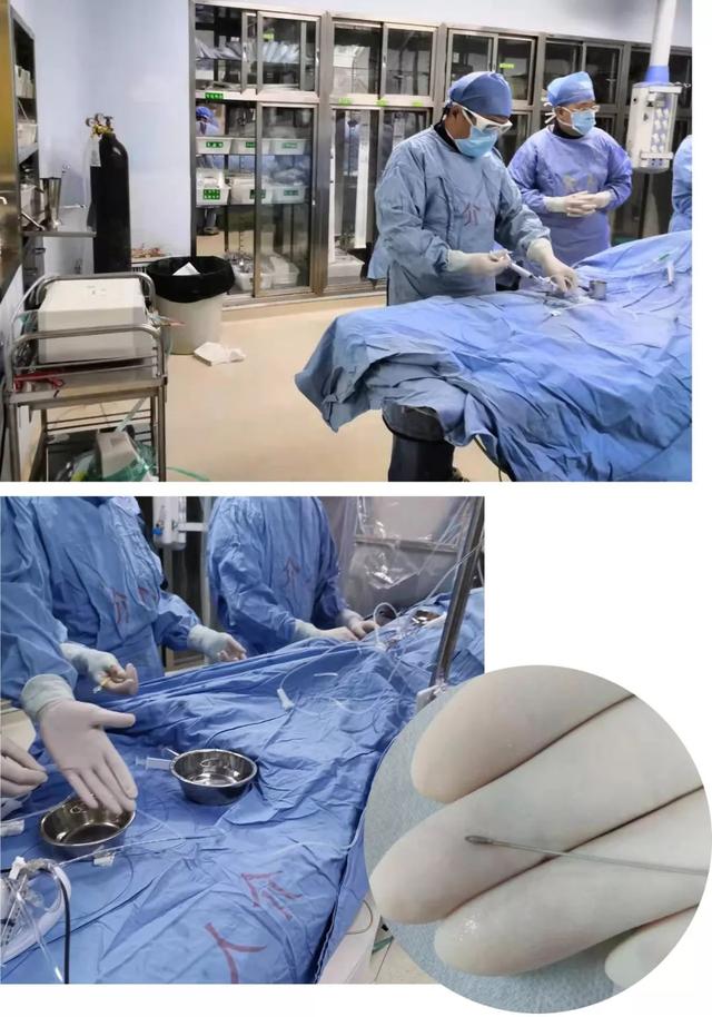 我院心內(nèi)科成功開(kāi)展我市首例冠狀動(dòng)脈旋磨術(shù)與血管內(nèi)超聲檢測(cè)技術(shù)